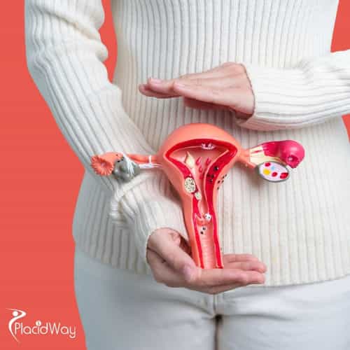 The Ultimate Medical Tourism Packing Checklist: Preparing for Your Tijuana Hysterectomy